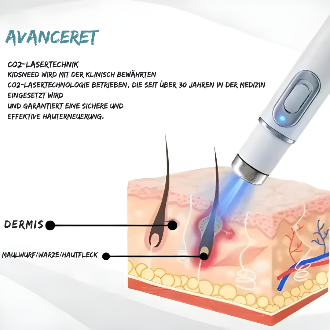 SilkLaser™ | Präzision und Sanftheit in einem