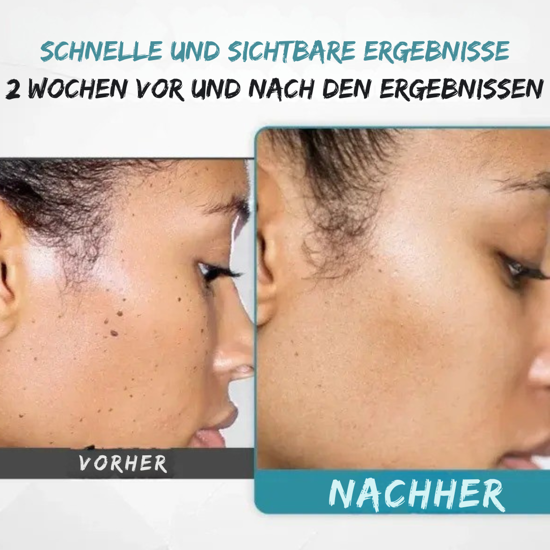 SilkLaser™ | Präzision und Sanftheit in einem